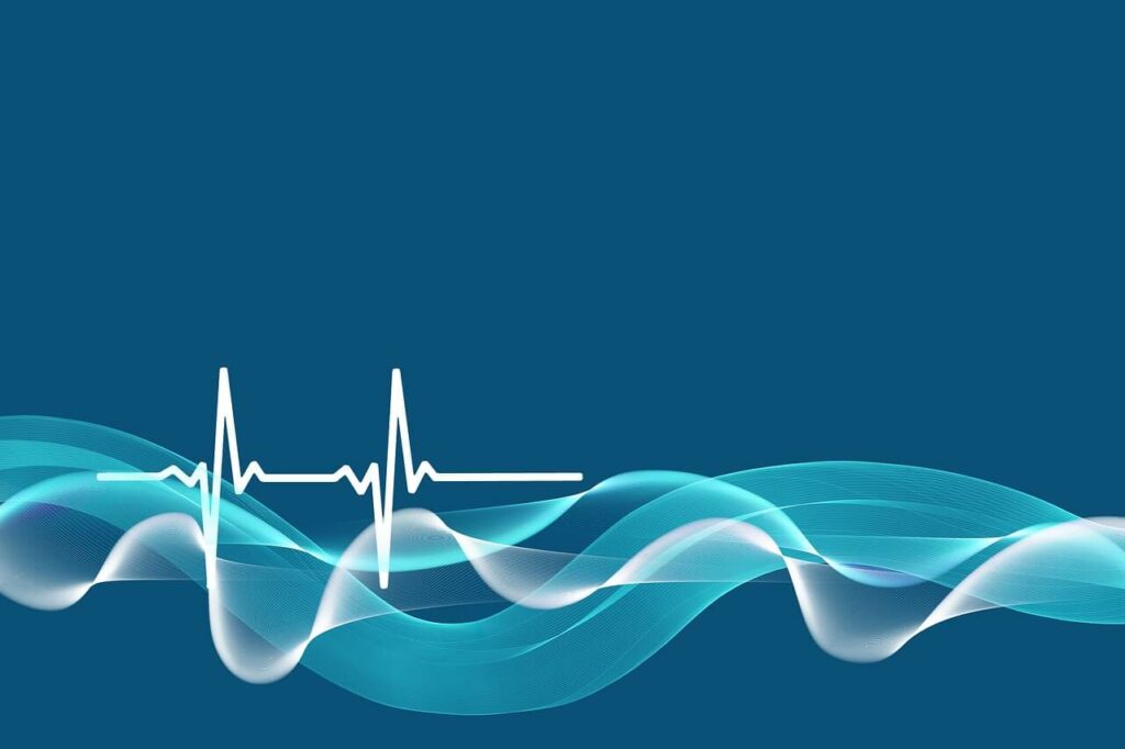 Image d'un électrocardiogramme. une façon d'illustrer les effets de la cohérence cardiaque. Un outil efficace utilisé en hypnose pour améliorer bon nombre de symptômes. Olivier MICHEL RENNES